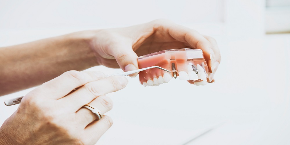 Denture Myths